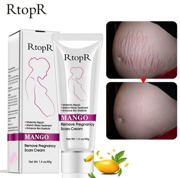 хорошие витамины для кожи: Крем от растяжек при беременности с экстрактом Манго  RtopR. Крем от