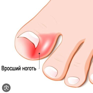 Маникюр, педикюр: Выравнивание, Наращивание ногтей, Донаращивание ногтей, Маникюр, Педикюр, Услуги подолога, С выездом на дом, Консультация, Одноразовые расходные материалы at lalafo.kg — 10 Маникюр, педикюр: Выравнивание, Наращивание ногтей, Донаращивание ногтей, Маникюр, Педикюр, Услуги подолога, С выездом на дом, Консультация, Одноразовые расходные материалы — 10