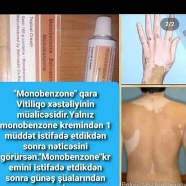 Bədənə qulluq: Menobenzone behvazan 20%.💯%Effektlidir Vitiligo, Cüzam, Sedef, kimi