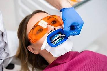 польский язык: White Smile — международная компания в сфере эстетического отбеливания — 1