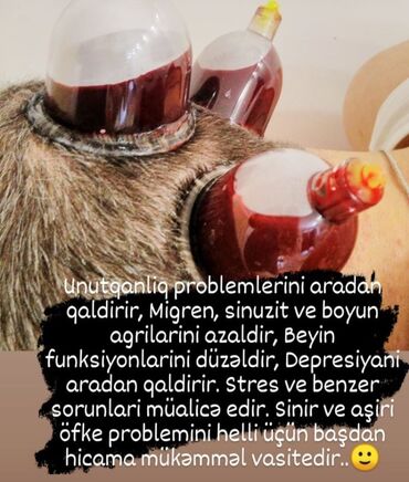 Hicama, zəli: Bəylər üçün = Hicama Və Zəli ✅Zəlinin Faydaları(Hirudoterapiya) — 1