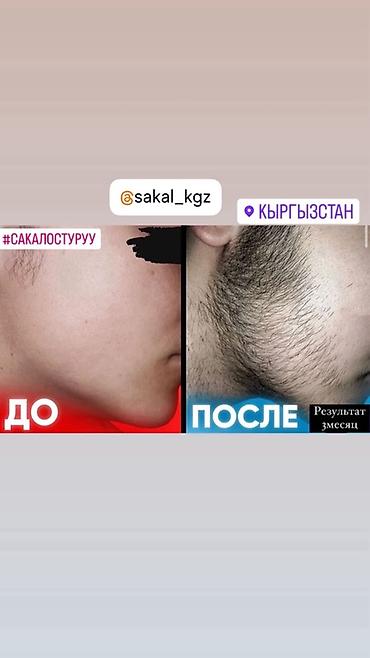 ред: REAXIDIL (Rijal) — сыворотка для роста волос и бороды Варианты — 1