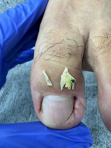 Маникюр: Коррекция вросших ногтей, Услуги подолога, Маникюр, Педикюр, Услуга в 4 руки, Одноразовые расходные материалы, Консультация — 3