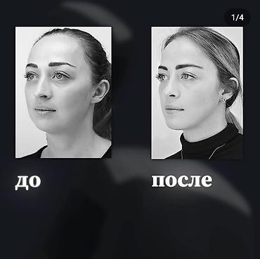 Машыктыргычтар: Эспандеры для лица !!! Осталось только 5 шт цвета : красные — 5