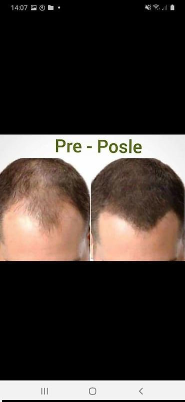 Nega kose: MBC Power and Protection Hair Conditioning Shampoo – — 10