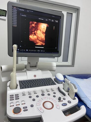 işlənmiş tibbi avadanlıqlar: Samsung Medison Sono Ase R7 2013 il 4 probe: linear, convex, vaginal