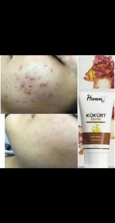 Şampunlar: Homm Bitkisel seriyası – yerli Türk istehsalı, duzsuz formul, bitki — 2