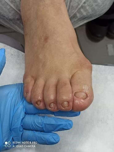 Маникюр: Ремонт сломаных ногтей, Наращивание ногтей, Донаращивание ногтей, Услуги подолога, Маникюр, Педикюр, Консультация, Одноразовые расходные материалы — 4