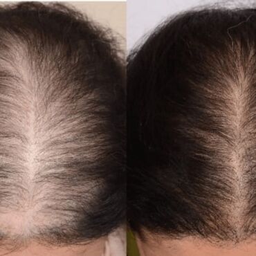 Косметология: Против выпадения волос Для роста волос Отличный результат Хотите