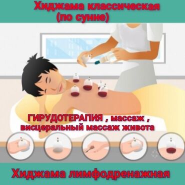 турмушун эшек араба в Кыргызстан | БАШКА А/Ч ЖАНЫБАРЛАРЫ: —Польза хиджамы В восточных и арабских странах часто применяется