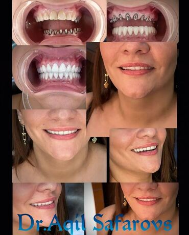 Stomatologiya: 💫Ramazan ayı ilə əlaqədar Kampaniya✨🌟⭐💫 🌊🔥Diş Həkimi 🔥🌊 Qiymətləri — 9