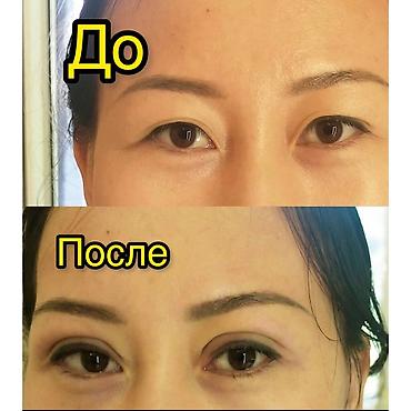 келет: Косметология, Ботокс, Беттеги безеткилерди дарылоо, Маскалар, Үйүнө баруу менен, Консультация, Гипоаллергендик материалдар — 2