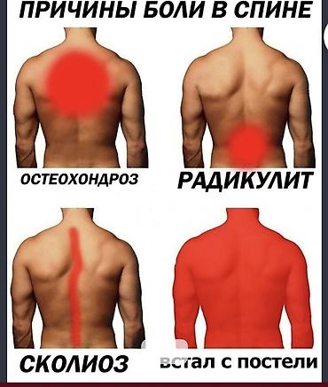 Массаж: Массаж | Лечебный массаж | Остеохондроз, Межпозвоночная грыжа, Кифос, лордоз — 6