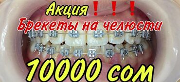 стоматологическое литейка в Кыргызстан | МЕДИЦИНСКОЕ ОБОРУДОВАНИЕ: Стоматолог | Реставрация, Протезирование, Чистка зубов | Круглосуточно