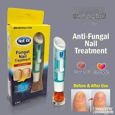 repom: Fungal Nail tretman – efikasan protiv gljivica na noktima Dobrodošli u — 1
