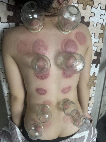 Массаж: Массаж | Спортивный массаж | Защемление седалищного нерва, Кифос, лордоз, Межпозвоночная грыжа | С выездом на дом — 4