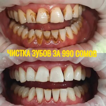 лазерная коррекция зрения: Врачи | Стоматолог | Диагностика, Консультация, Протезирование