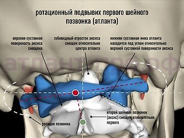 шейный машины: Врачи | Костоправ — 1