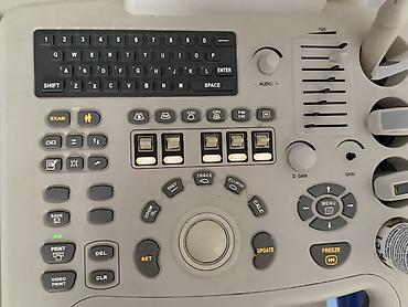 dinakort aparat: SinoSonic SonoScape SI-6000 ultrasəs diaqnostika aparatı — 10