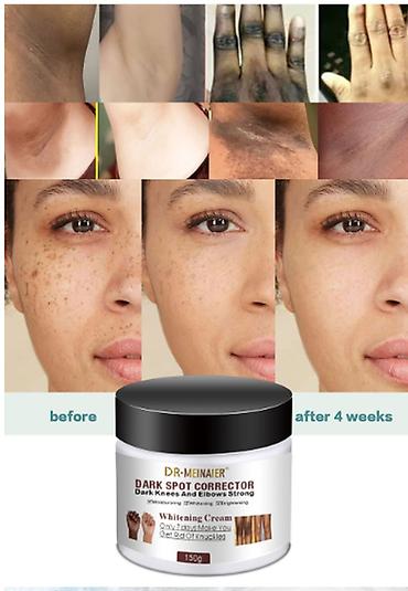 expigment реальные отзывы: ❄️ США Корректор темных пятен для лица а так же на на костяшках, зоны — 5