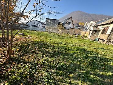 sans tibb merkezi gence: 11 sot, Tikinti, Kupça (Çıxarış) — 4