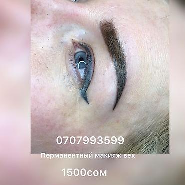 Косметология: Косметология, Ботокс, Биоревитализация, Ботулинотерапия, С выездом на дом, Консультация, Гипоаллергенные материалы — 15