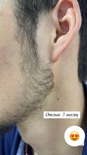 Уход за телом: Миноксидил 5% США🇺🇸 100% оригинал✅ рост борода и волосы, магазин — 4