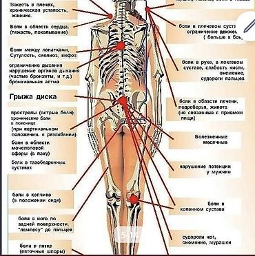 Массаж: Массаж | Лечебный массаж | Остеохондроз, Межпозвоночная грыжа, Кифос, лордоз — 15