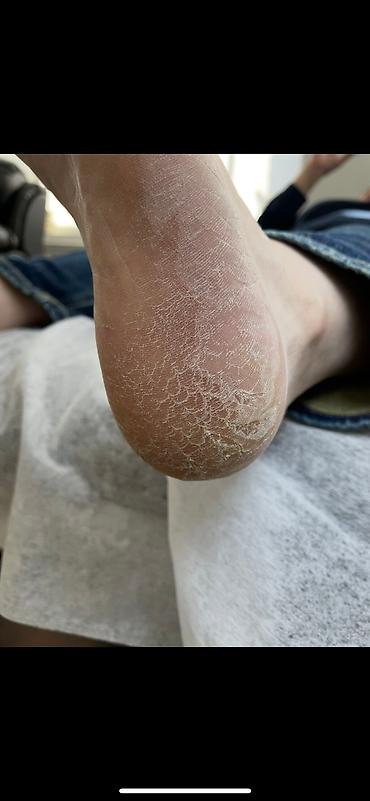 Маникюр, педикюр: Коррекция вросших ногтей, Услуги подолога, С выездом на дом, Консультация, Одноразовые расходные материалы — 5