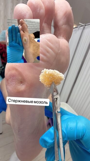 сауна домашняя: Услуги подолога, Одноразовые расходные материалы