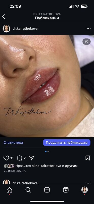 Косметология: Косметология, Биоревитализация, Ботокс, Ботулинотерапия, Требуются модели, Гипоаллергенные материалы, Консультация — 8