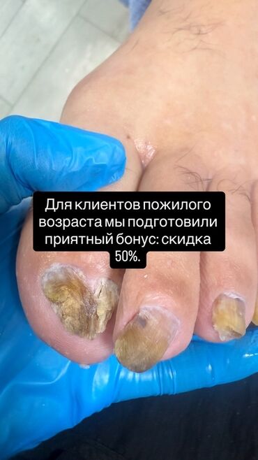 прокол ушей с выездом на дом: Предлагается услуга подологии, направленная на уход за стопами и