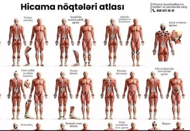 sumqayitda tibb bacisi isi elanlari: Salam kime venadaxili ezeledaxili iyne.hicama