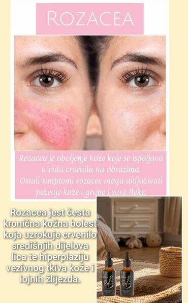 Suplementi: Refine kapi – prirodni dodatak ishrani na bazi ginka bilobe - Podrška — 11