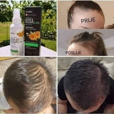 Nega kose: KosaLim 💚 Kosalim je kombinacija prirodnih ekstrakta lekovitog bilja na lalafo.rs — 2 Nega kose: KosaLim 💚 Kosalim je kombinacija prirodnih ekstrakta lekovitog bilja — 2