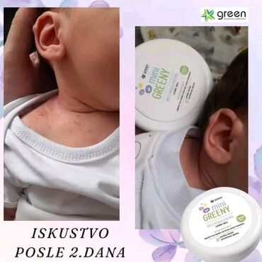 Nega kože: 🌿GREEN🌿 💚Mini Greeny - kolekcija za bebe i decu 💭 Dozvolite i vašem — 7