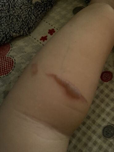 Setovi stolova i stolica: Trpezarijski set – sto i 4 stolice Cena kompleta 220e Stolica — 3