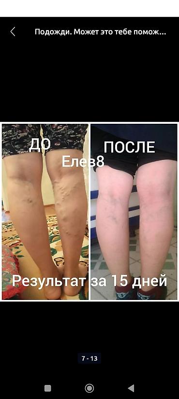 Витамины и БАДы: #Клеточное питание, #Витамины#елев8, #акселлер8, #редженер8 — 7