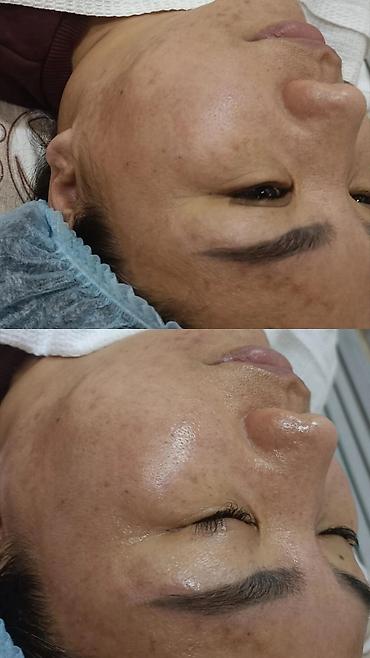 Курсы массажа: Курсы массажа | Классический массаж, Лечебный массаж, Вакуумный массаж — 8