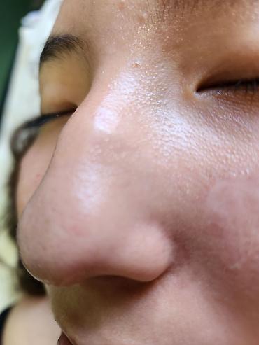 clean point: Косметология, Чистка кожи, Консультация — 2