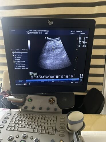 stomatoloji avadanliqlar: GE Healthcare LOGIQ P6 ultrasəs diaqnostika sistemi - Tam funksional