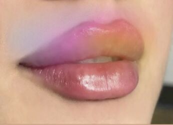 Digər gözəllik və estetika cihazları: Plastik estetik hər yüksək səviyyə uyğun qiymət!!!Burdan mesaj — 4