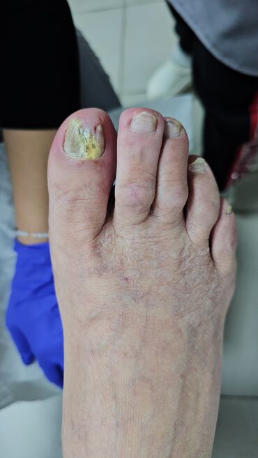 Маникюр, педикюр: Наращивание ногтей, Гель лак, шеллак, Укрепление ногтей, Услуги подолога, Маникюр, Педикюр, Консультация, Одноразовые расходные материалы — 4