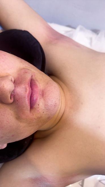 Эпиляция: Мужской шугаринг. Восковая депиляция — 14