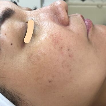 Косметология: Косметология, Чистка кожи, Биоревитализация, Пилинг, Сертифицированный косметолог, Гипоаллергенные материалы, Консультация — 7