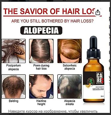 Уход за телом: США средство от облысения от выпадения волос для роста волос будит — 16