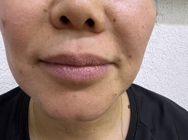 Косметология: Косметология, Маски, Мезотерапия, Удаление носогубных складок, Гипоаллергенные материалы, Консультация, Сертифицированный косметолог — 38