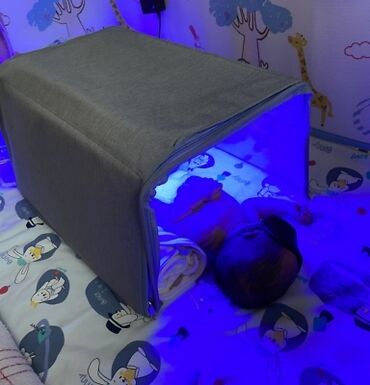 уфо лампа: Фотолампа от желтухи в аренду для новорожденных малышей. Снижает