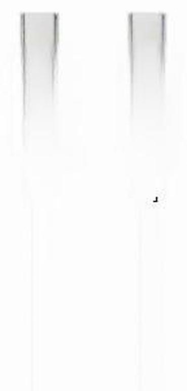 Kablovi za telefone: USB-C to USB-C kabl Cablexpert 100 W PD, dužina 1,5 m. Ključne — 7