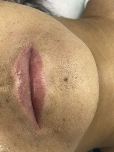 Косметология: Косметология, Маски, Мезотерапия, Удаление носогубных складок, Гипоаллергенные материалы, Консультация, Сертифицированный косметолог — 26